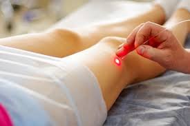 varicose veins surgery cost in hyderabad laser